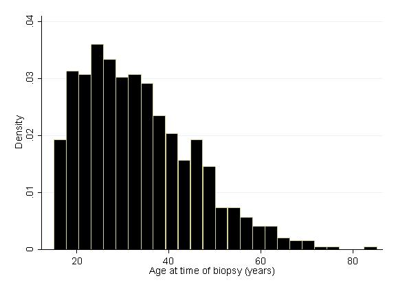 4 Total 437 100 147 100 125 100 709 100 Figure 2.4.2(a): Demographic characteristics for IgAN, 2005-2012 Figure 2.4.2(b): Age at time of biopsy (year) IgAN, 2005-2012 2.4.3: Clinical presentation Asymptomatic urine abnormalities remains the most common presentation of IgAN (48.