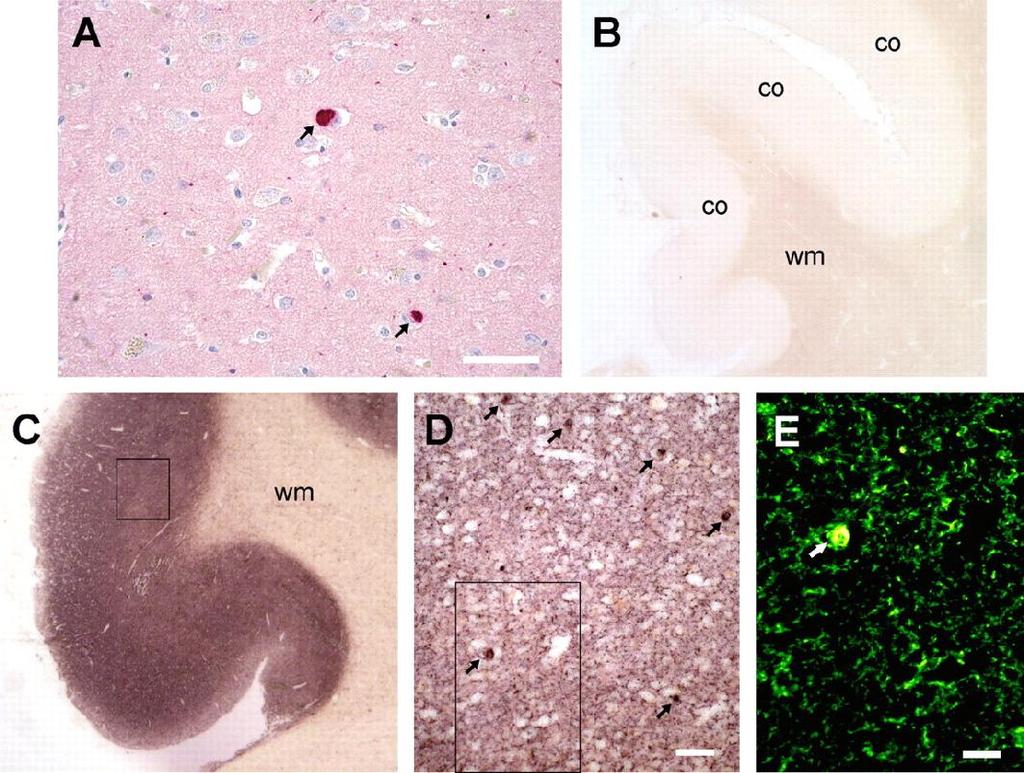 Revealing previously undetectable, small granular α-synuclein aggregates with