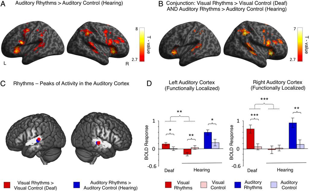 Table S2). This result confirms that visual rhythms induced significant auditory cortex activations only in deaf subjects.