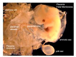 or Amnion is the upper most non adherent Ectodermal layer of placenta that is facing the fetus HAM-Histology It has a single layer of