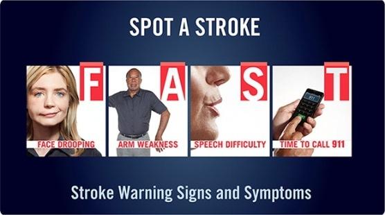 Illinois Stroke Data Report 1 Background 1 Every year, 795,000+ people in the US have a stroke (every 40 seconds) Stroke kills almost 130,000 Americans each year (every 4 minutes) Stroke is the third