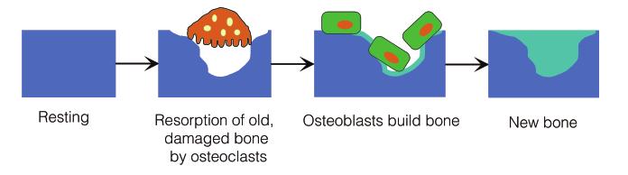 How does Paget s disease affect bone? Bone is an active living tissue that is constantly being renewed through a process known as remodelling.
