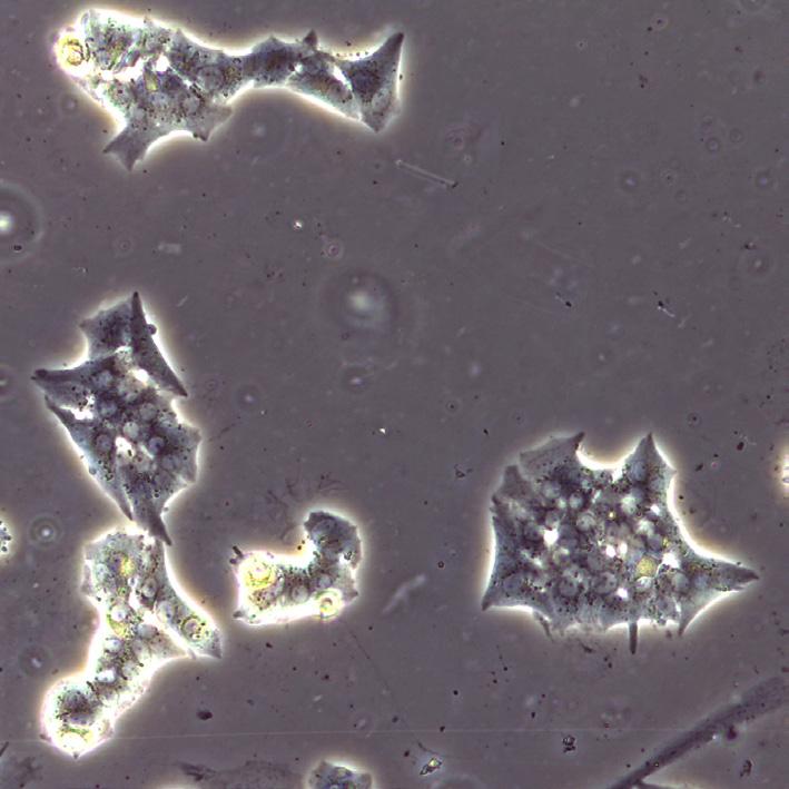 a Human islet cells, 7 days, No ARA-C Hu islets cells, 7 days, ARA-C 3 µm b Hu islets cells, 7 days, ARA-C 3 µm Beta-actin DAPI Human islet cells, 7 days,