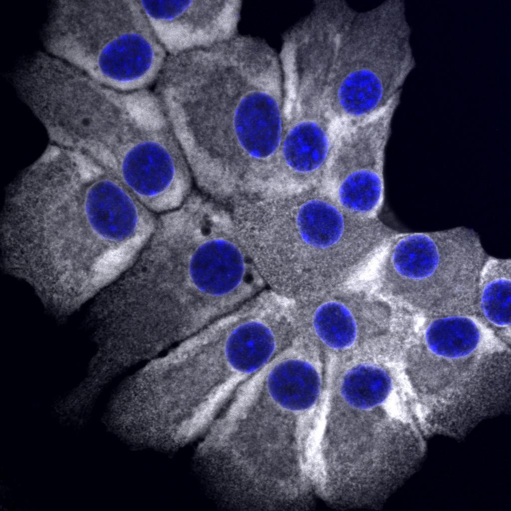 (c) A representative confocal image of adult human islet cells from an 18-yearold donor, cultured for seven days on collagen