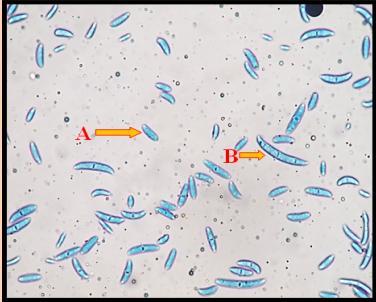 Fig.3 a) Microconidia, b) Macroconodia Fig.4 a) Chlamydospore, b) Mycelium It is revealed from these observations that sporulation has relevance with virulence of the isolates.