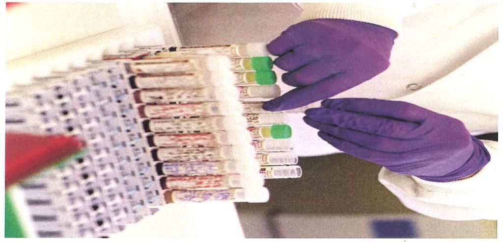 Considerations For Good Practice Minimise amount of phlebotomy for lab samples especially in small children Base practice on transfusion triggers, targets set by
