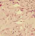 Outer Layers Regenerated Dura Inner Layer Arachnoid Cortex Blood Vessels Cranial Margin 60 Days Post Implantation - Porcine Study**