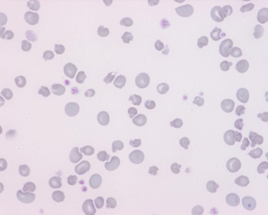 Figure 2: Picture of the blood smear edge (1000x, modified May-Grünwald Giemsa staining).