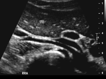 Ultrasound of the