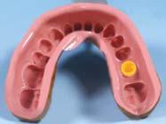 5mm 4mm Excellent Solid impression coping for non-modified abutments Color-coding : In order to facilitate identification, the Excellent Solid impression copings are color-coded : Height 4.