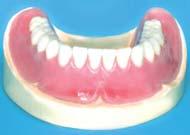 to the lab, where the denture teeth shall be arranged on the wax rim based on the delivered