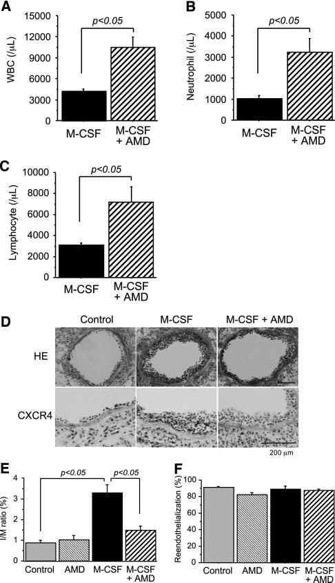 Shiba et al M-CSF and SDF-1 CXCR4 System After Vascular Injury 287 Figure 6. Effect of M-CSF on CXCR4 expression in vitro.