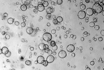 (B) The majority of organoids are larger than 100 µm and the lumens of a few organoids