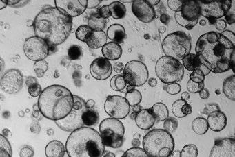 (C) Organoids have passed the typical passage window; the lumens of most organoids have
