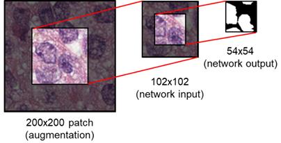 3.2 Experimental evaluation of deep learning method for segmentation of nuclei From the original 32 training image tiles, with no additional preprocessing steps, multiple patches (~100 per image) of