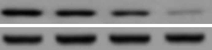 HT-29 cells were treated with gambogic acid (GA) for 48 h and Western blot was performed to measure levels of Fas receptor (A); Fas ligand (FasL) (B); FADD (C); apaf-1 (D); cytochrome c (E);