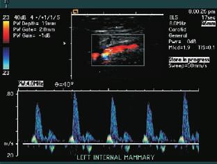 Energy in this normal carotid anatomy enhances diagnostic information about