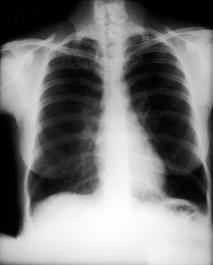 Cardiology The Pulmonary