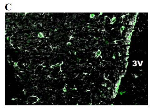 hypothalamus of Ad- GFP injected rats.
