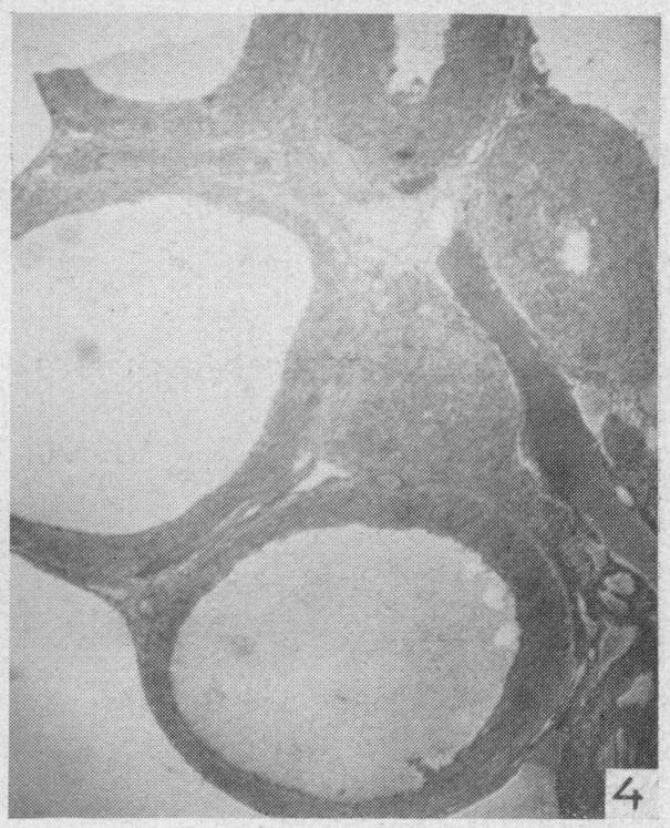 A section of a rat ovary that had been treated with 7 i.u.