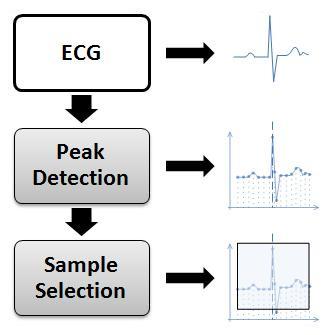 In order to remove noise from the ECG signal. The steps in the pre processing process are a) Display of raw ECG signal to its physical units. b) Removing baseline drift. c) De noising of ECG signal.