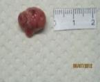 A-431 tumors from control