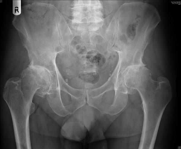 Radiographic Assessments All radiographs were assessed for: Individual features
