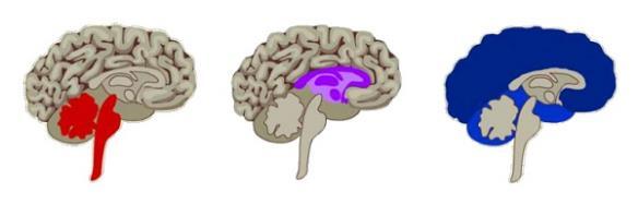 Lizard Brain Mammal Brain Human Brain Brain Stem Cerebellum Limbic System Neocortex Fight or Flight or Freeze