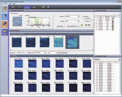 Imaging MS Solution Software For Efficient Statistical Analysis Imaging MS Solution is a new software program designed specifically for the imscope, which integrates optical and mass image