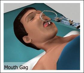 Genioglossus and hyoid advancement are also surgical options to treat sleep apnea.
