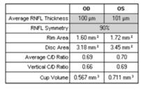 Normative Data: Glaucoma Average RNFL