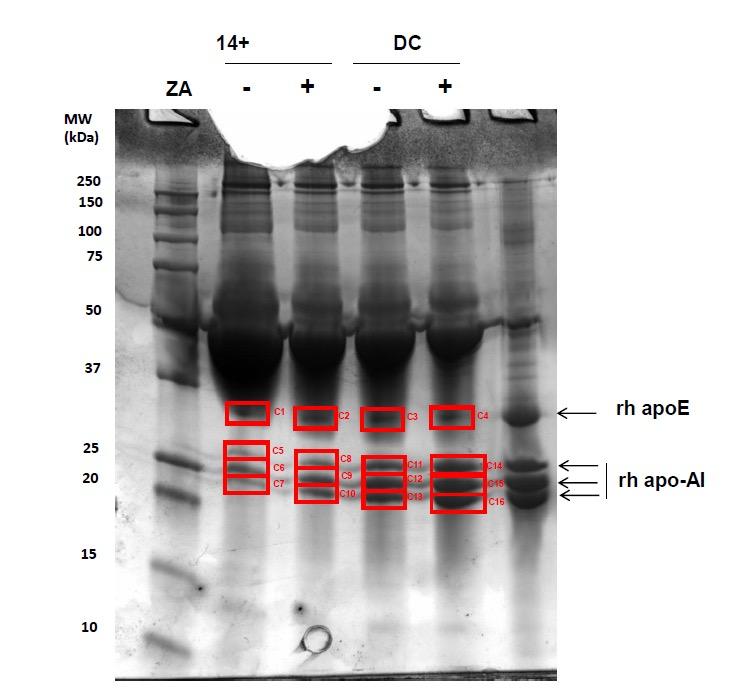 Supplementary Figure 1. Supernatants electrophoresis from CD14+ and dendritic cells. Supernatants were resolved by SDS-PAGE and stained with Coomassie brilliant blue.
