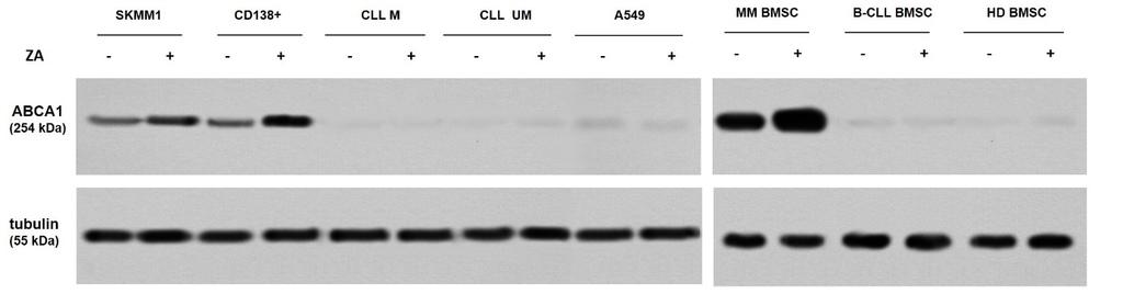 Supplementary Figure 3. ZA-induced ABCA1 upregulation in different cells.
