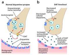 2 Dopaminergic neurotransmission Physiologic processes: reward addiction movement lactation Improper dopaminergic tone Schizophrenia Parkinson's disease drug addiction Parkinson Loss of dopaminergic