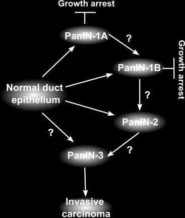 Alternative hypothesis for PDAC progression (non-linear) PanIN-1 lesions may follow a progression route different from PanIN-2/3 PanINs-1: lead to growth arrest (?