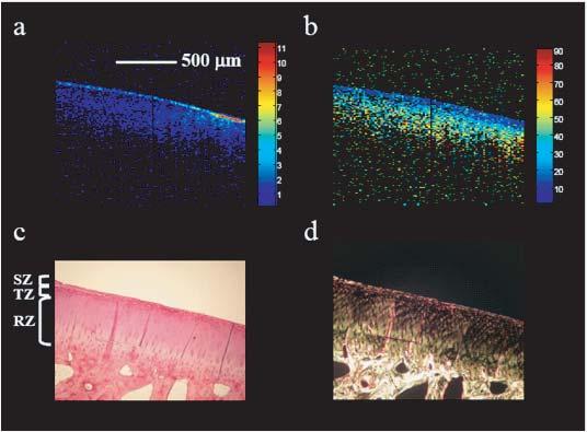 Progress In Electromagnetics Research, PIER 91, 2009 369 (a) (b) (c) (d) Figure 2. PS-OCT and the corresponding histological images of visually healthy cartilage.