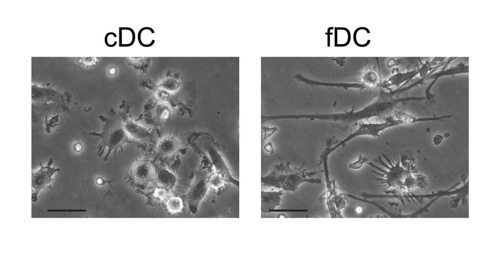Grafikon 5.1.1. Ekspresija CD14 i CD33 molekula na površini monocita. Monociti su izolovani iz populacije PBMC negativnim MACS, nakon čega je analizirana ekspresija CD14 i CD33 na njihovoj površini.