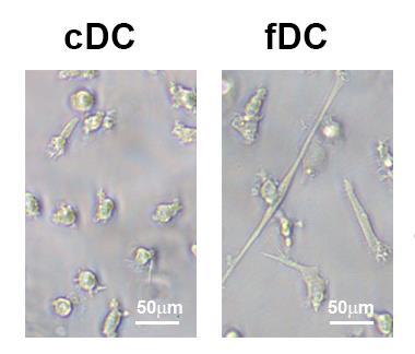 Slika 5.5.1. Izgled fdc i cdc loših respondera u kulturi. Slike cdc i fdc su dobijene pomoću fazno-kontrasnog svetlosnog mikroskopa 48h nakon stimulacije sa Poly (I:C). Grafikon 5.5.3.