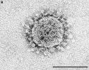 SARS: Coronavirus (CoV) Identified 1 CPE in cell culture and EM: RT-PCR analysis confirms identity Demonstration of seroconversion Interstitial pneumonia in monkeys 1. C. Drosten, et al.