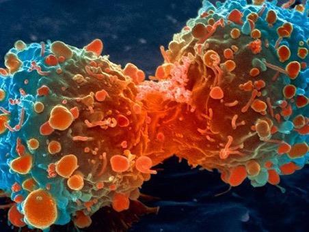WHAT IS CANCER? A disease caused by an uncontrolled division of abnormal cells in a part of the body.