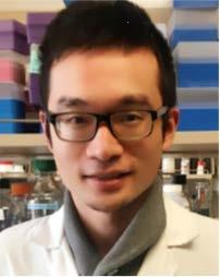 Xilin Li Indiana University, Bloomington Title: Role of micrornas in Non-Alcoholic Fatty Liver Disease Session: