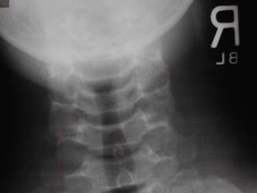 A-5-3 Radiologist s report: There