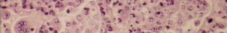 RSV life cycle: syncytia multi nucleated giant cells pathmicro.med.sc.