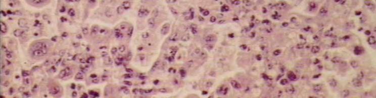 jpg RSV Pathogenesis replicates in cells of nasopharynx transmission by