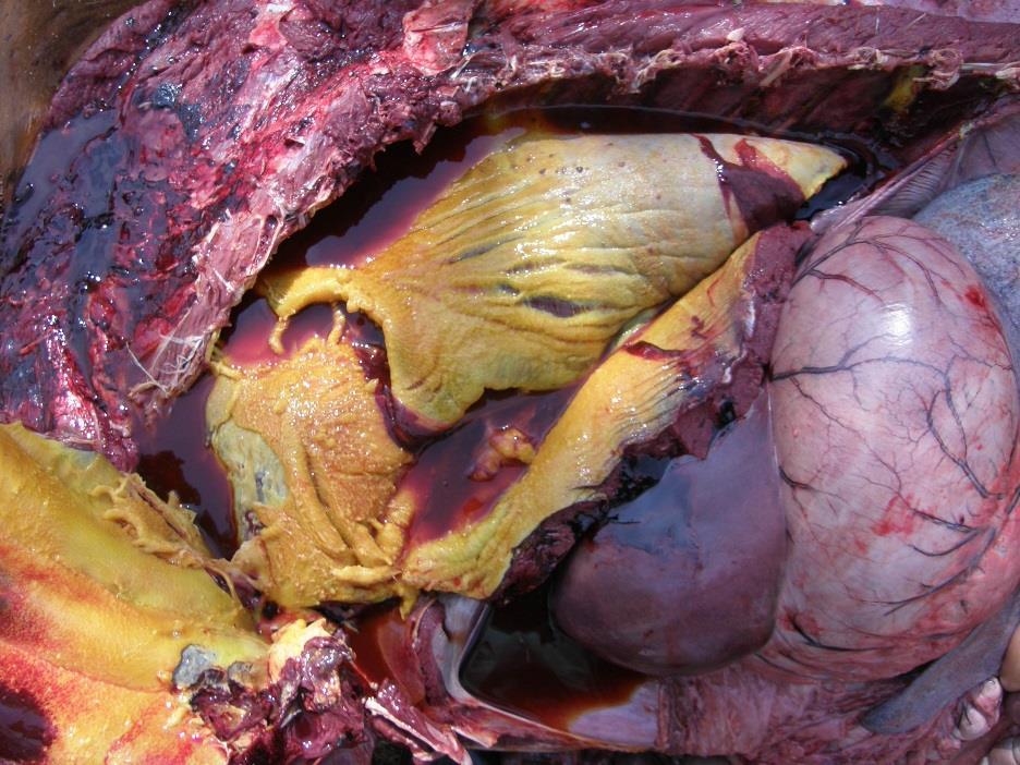 Inflammation of the pleura covering the lungs is termed visceral pleurisy / pleuritis while that involving the costal wall surface is termed parietal pleurisy / pleuritis.