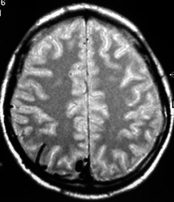 IMAGING MRI plain and Gad-enhanced