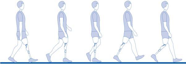 Functions of prostheses (stance phase) Shock absorption Advace of ibia GCM