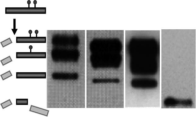 FIGURE 4-2 Western blot comparing the major isoforms observed in the four principal subtypes of prion disease.