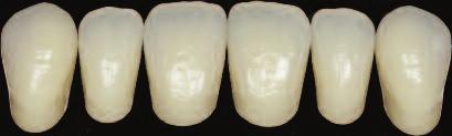 Mould IT6 shown Subtle darker necks like natural teeth Internal structures of natural teeth
