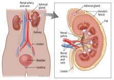 Anatomy & Pathophysiology 90% of kidney cancers are renal cell carcinoma Arise from renal tubular epithelial cells 70 80% clear cell (cc) histology 20 30% non clear cell histology 5 10% of kidney